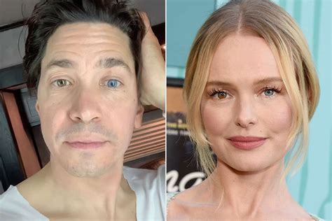 kate bosworth eyes|Justin Long teases Kate Bosworths different eye。